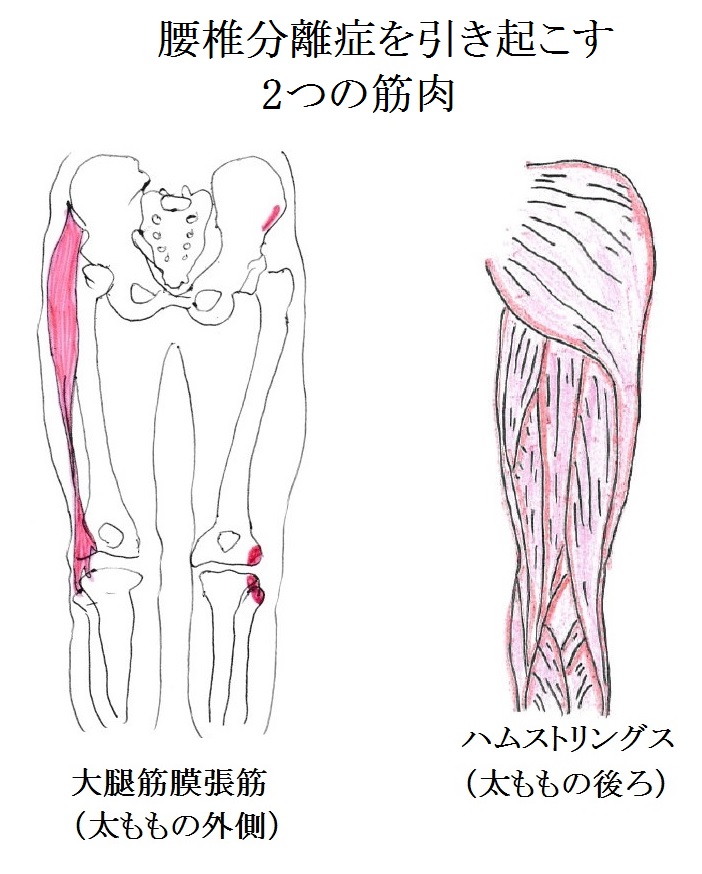 2箇所筋肉画像