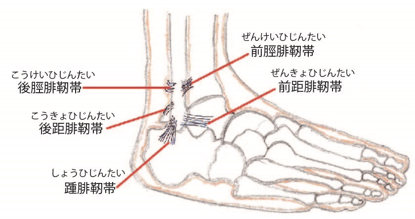 捻挫の治療<