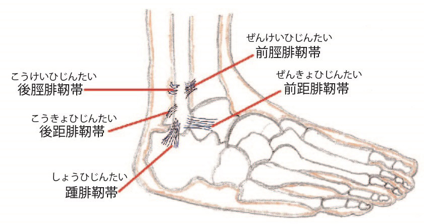 内反捻挫で炎症を起こす靭帯のイラスト