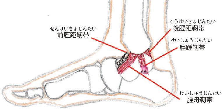 外反捻挫で炎症を起こす靭帯のイラスト