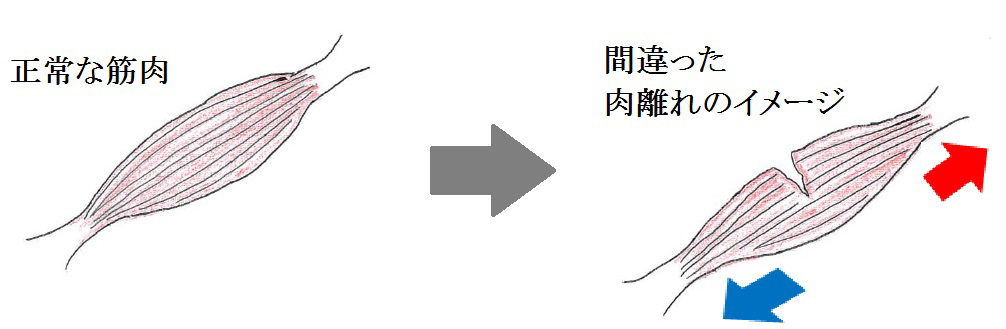 あなたの肉離れが治らないのは間違った思い込みを
          <br>
しているからです！