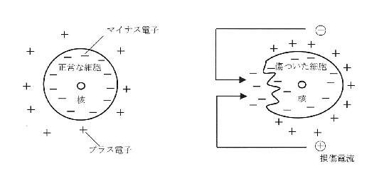 電流を流すとスポーツ復帰を早められるワケ